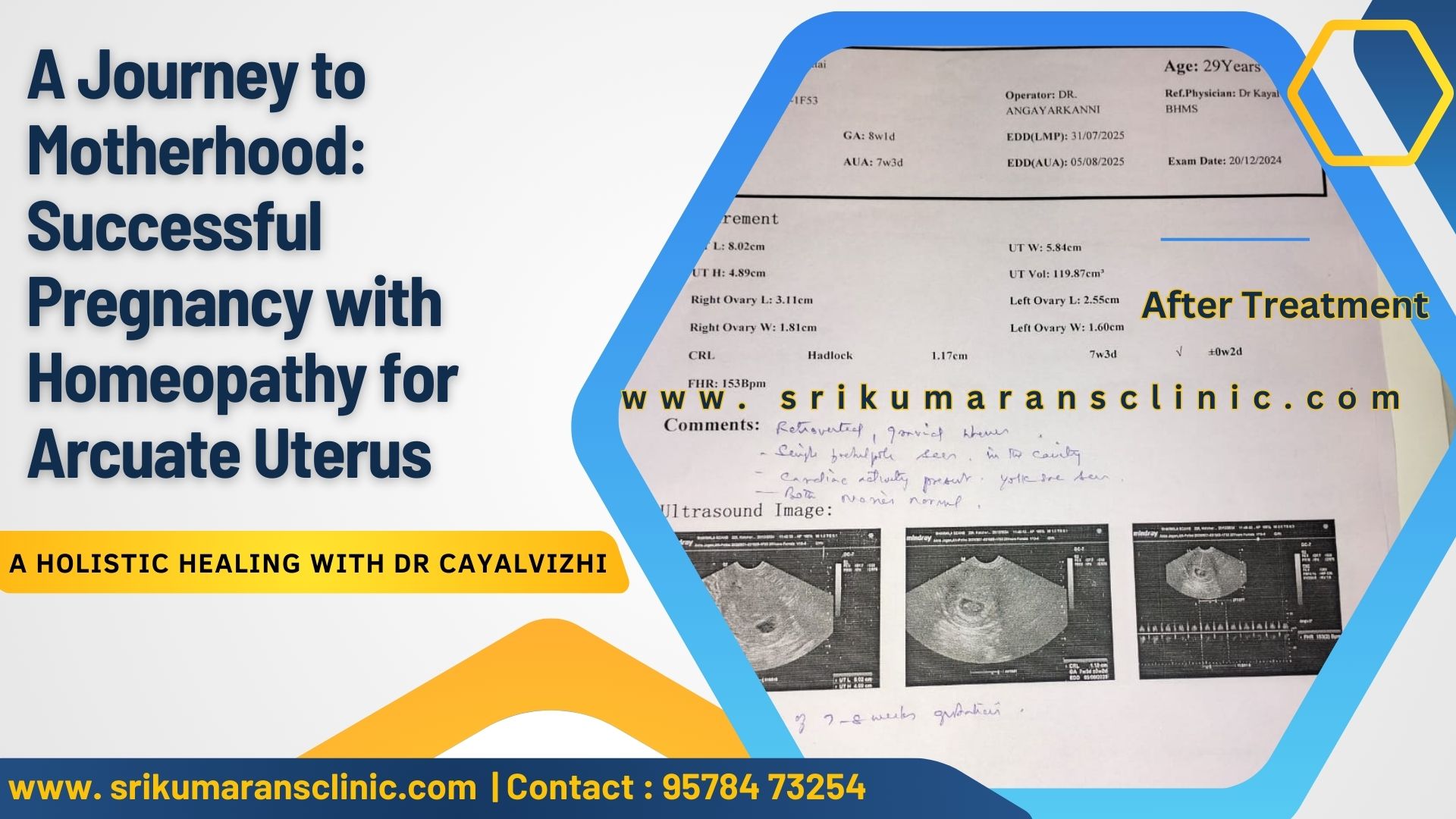 Protected Case Image