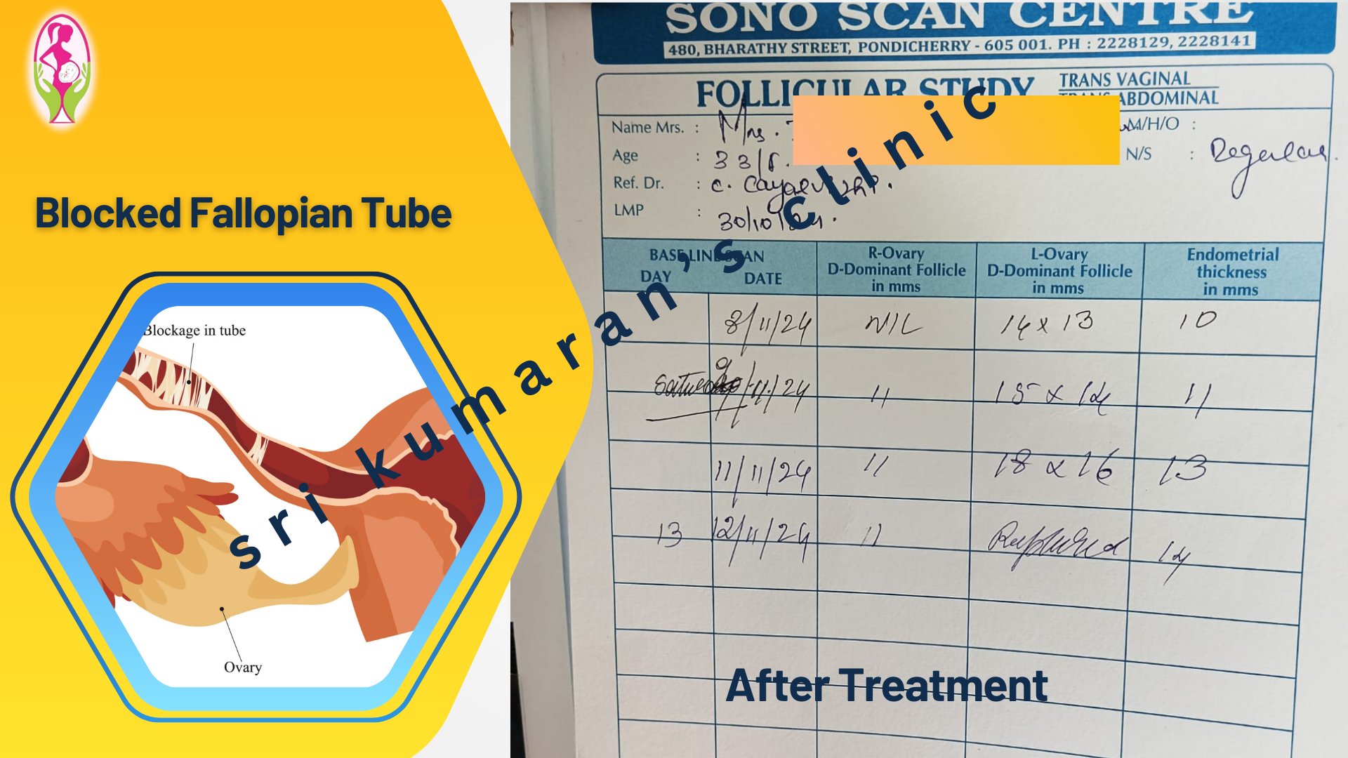 Protected Case Image