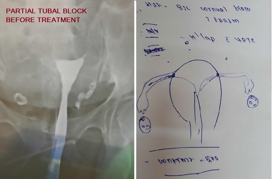 Protected Case Image